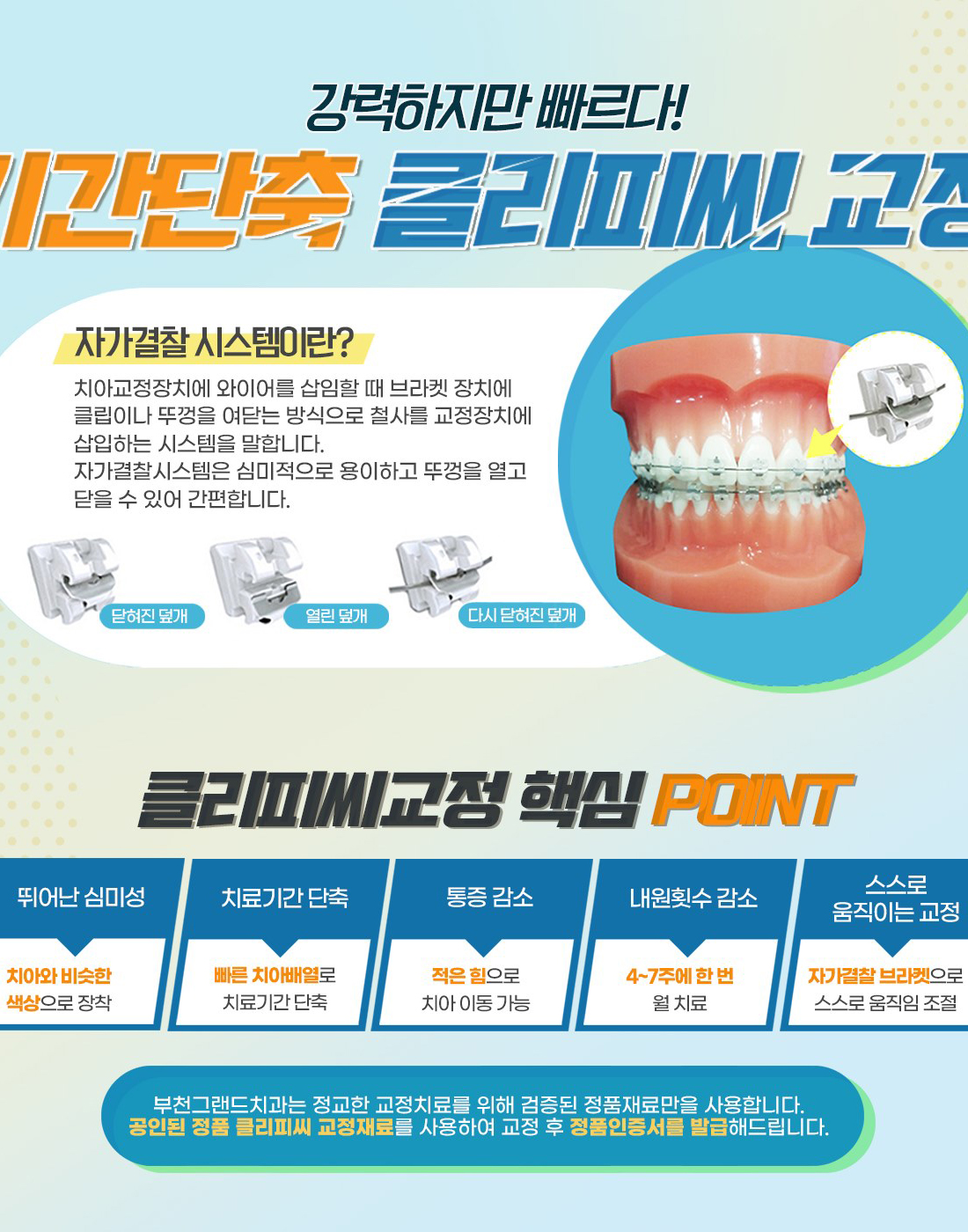 부천치과 클리피씨교정